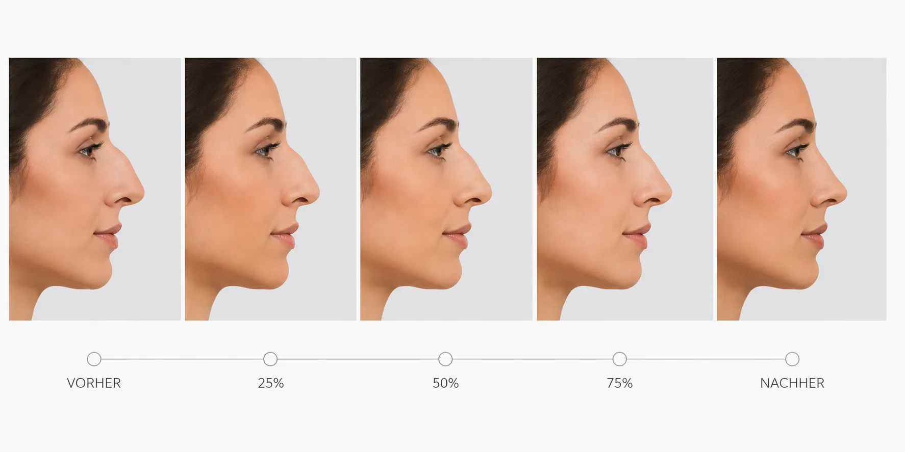 Höckernase Morphing Simulation
